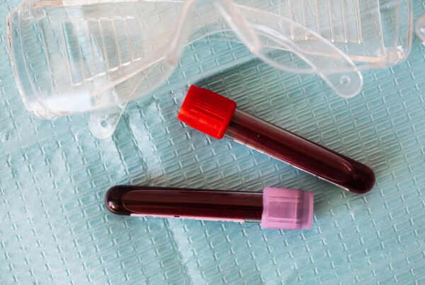 Blood samples-Image by South African Government-via X